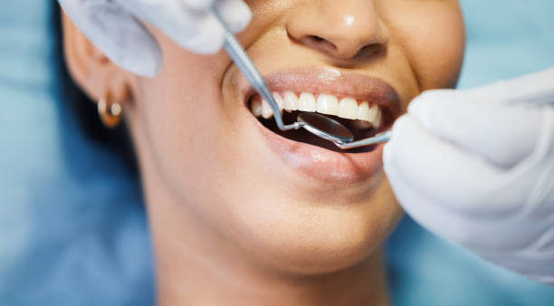 Best Emergency Wisdom Teeth Removal in Homer, AK